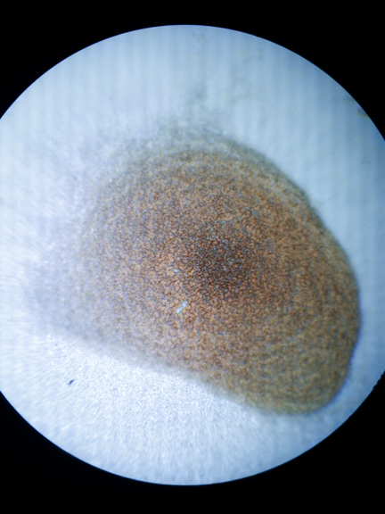 Centro_Holistico_JackieGo_DryBloodAnalysis