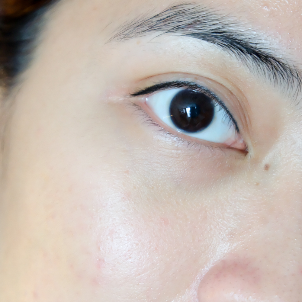 Up&UpSkinLIftingSerum_JackieGo_After