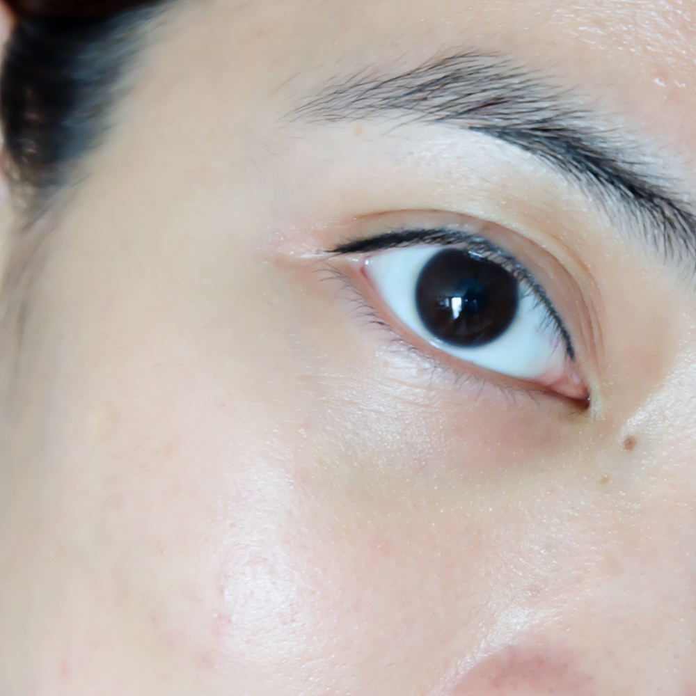 Up&UpSkinLIftingSerum_JackieGo_Before