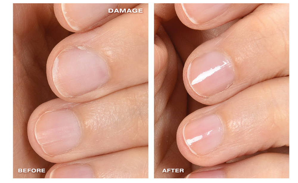 ZoyaNakedManicure_BeforeAfter