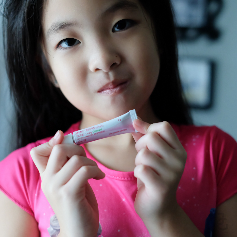 Achievement Unlocked: Coping With Eczema